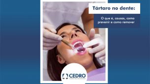 Tártaro no dente: o que é, causas, como prevenir e como remover